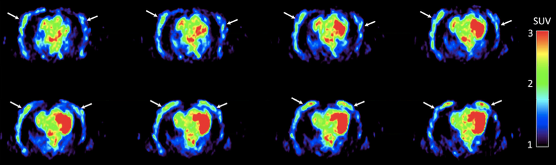 PET scan of Hof. 