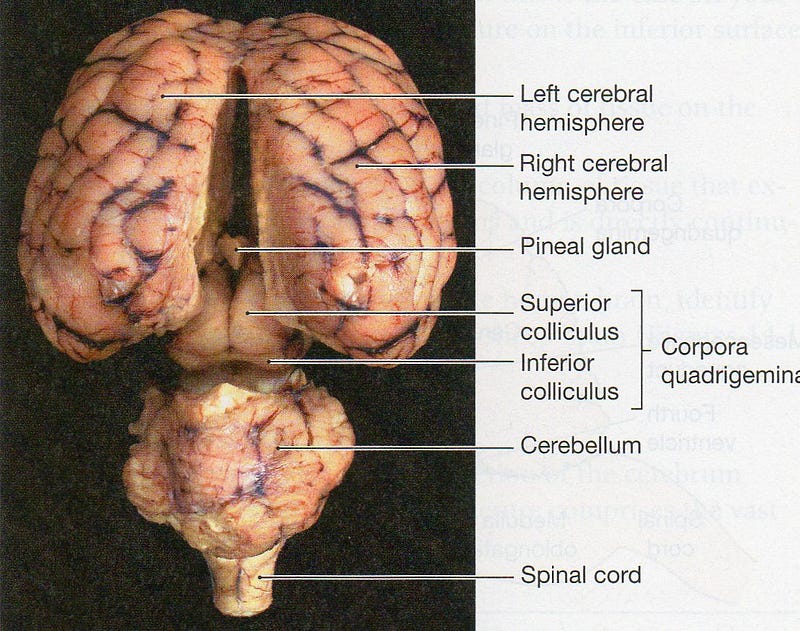 Pineal gland—epiphysis.