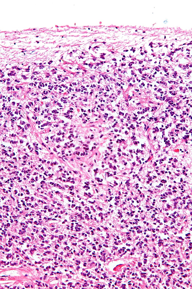 Transverse section of the epiphysis showing pinealocytes and other cells.